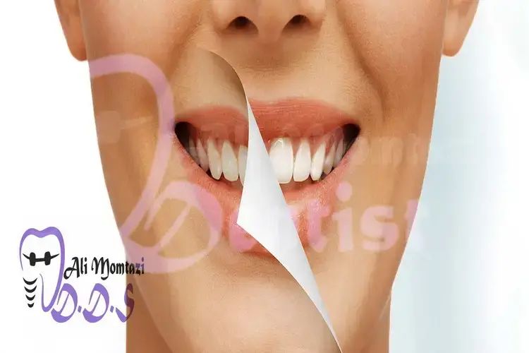 خدمات دندانپزشکی زیبایی