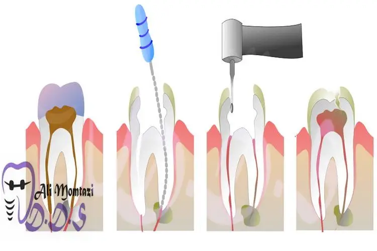 خدمات درمانی ریشه