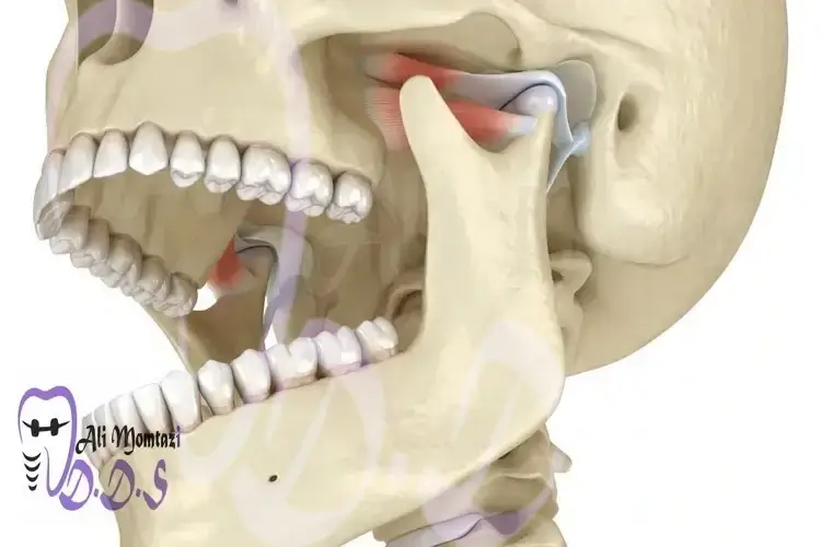 اصلاح ارتفاع دندان و رابطه فکی