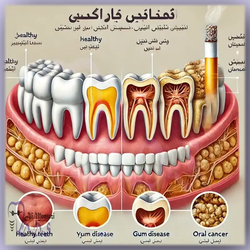 تأثیر سیگار و مصرف تنباکو بر دهان و دندان | آموزش توسط دکتر علی ممتازی