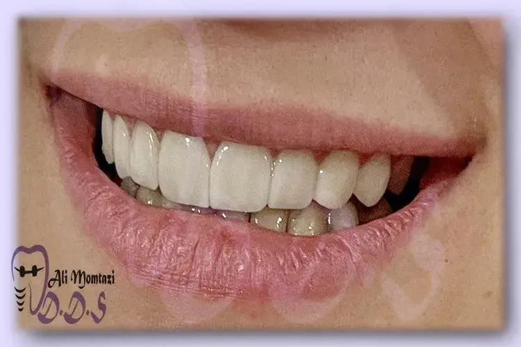 اصلاح طرح لبخند دکتر علی ممتازی