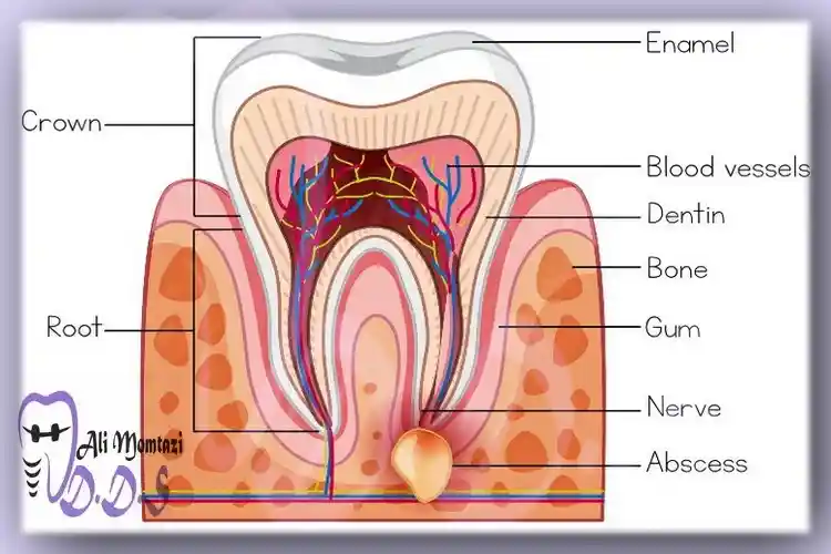 کیست نوک ریشه دندان چیست؟ آموزش توسط دکتر علی ممتازی