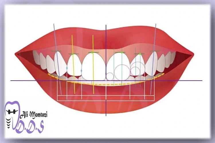 طراحی لبخند چیست؟